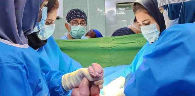 زایمان موفق سه مادر پر خطر در رشت انجام شد