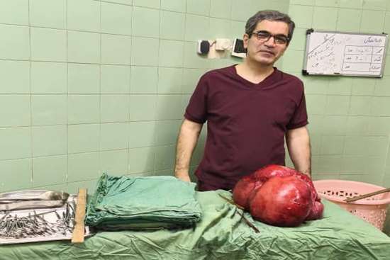 عمل جراحی نجات‌بخش در بیمارستان شهید انصاری؛ توده‌ای به وزن ۱۰ کیلوگرم از شکم بیمار خارج شد